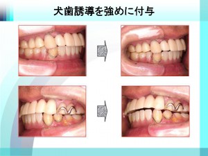 入れ歯 義歯 予約可 公式 赤坂の歯医者 赤坂デンタルオフィス 土日診療