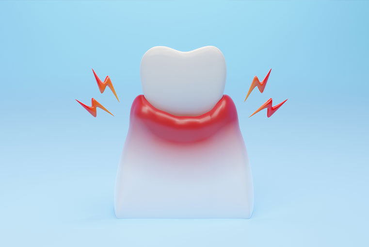歯や歯肉の問題による痛み