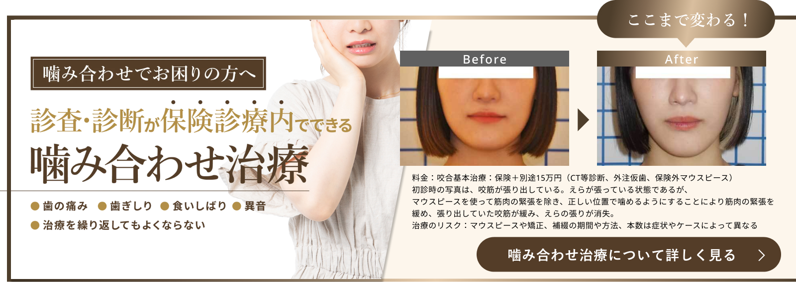 噛み合わせ相談