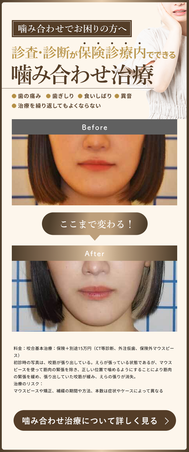 噛み合わせ相談