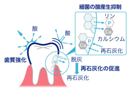 赤坂デンタルオフィスの予防歯科